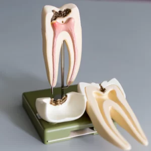 لیست اسم وسایل عصب کشی دندان
