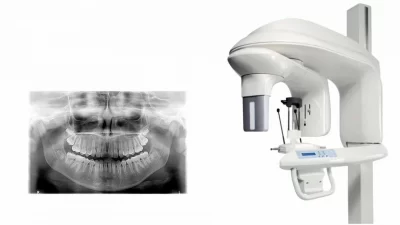 دستگاه رادیولوژی داخل دهان و دستگاه رادیولوژی خارج از دهان از انواع دستگاه رادیولوژی هستند.