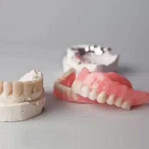 بهترین زمان قالب گیری دندان