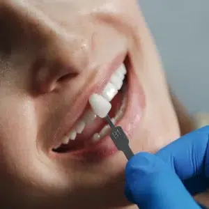 اواع برند کامپوزیت آی پی اس