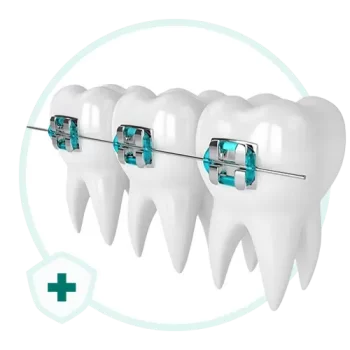 خرید دسته بندی مواد ارتودنسی دندانپزشکی