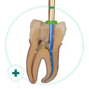 خرید مواد ضدعفونی کننده کانال دندانپزشکی