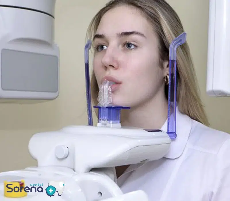 رادیوگرافی برای تشخیص دندان های نهفته