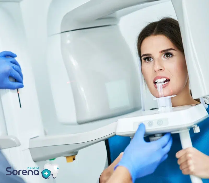 رادیوگرافی پانورامیک