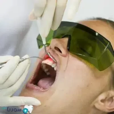 جراحی بازسازی انساج لثه چیست