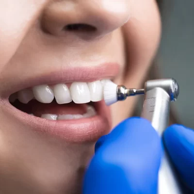 abrasive finishing and polishing in restorative dentistry