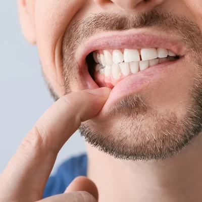 how do you know if your tooth enamel is gone