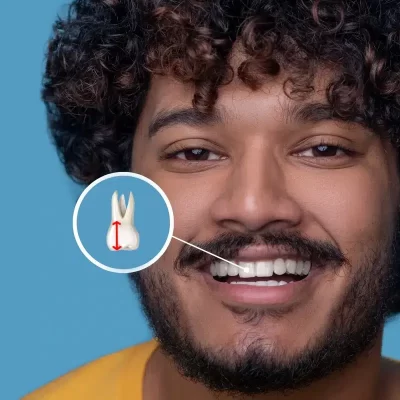 اندازه میانگین دندان ها