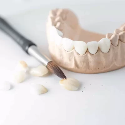 types of dental composite models