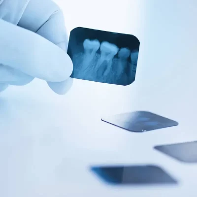 فیلم رادیوگرافی چیست