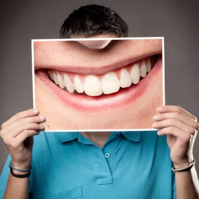 بهترین برند کامپوزیت دندان