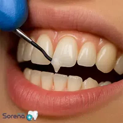 بهترین برند کامپوزیت​